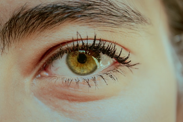 6 principais causas do terçol no olho - Por que ele aparece?